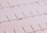 Electrocardiogram