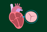 Heart valve