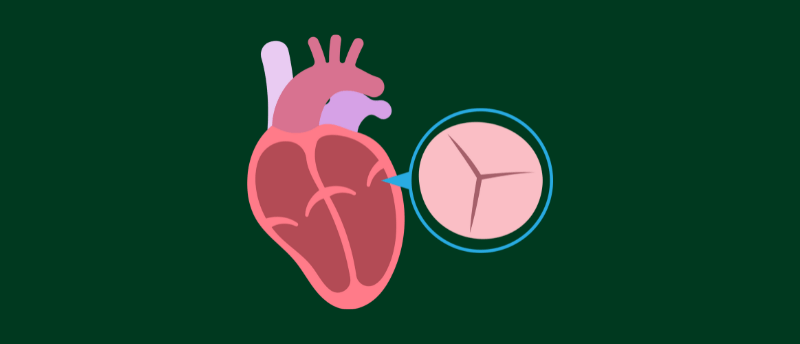 Heart valve