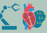 remote ECG